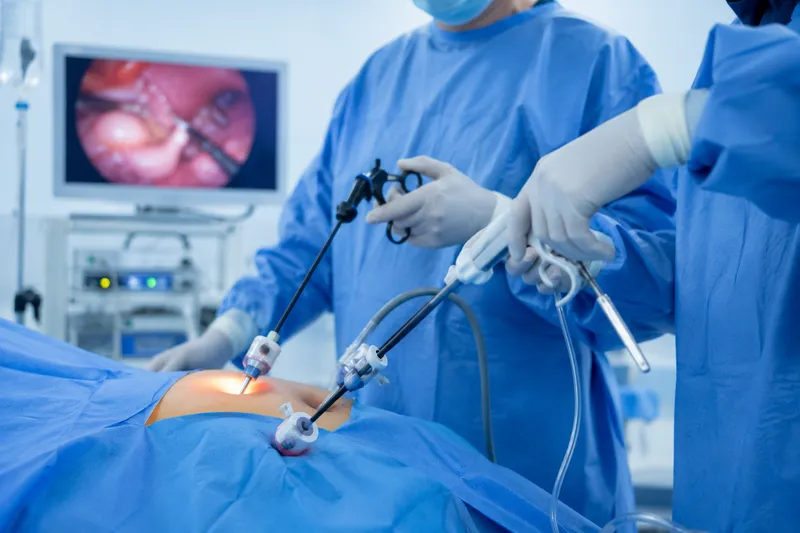 Laparoscopic gallbladder surgery