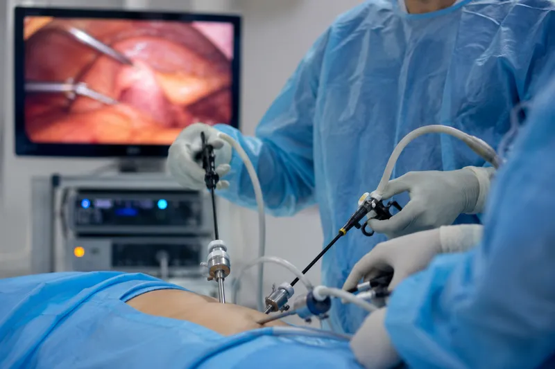 Modern operating theatre equipped for laparoscopic surgery